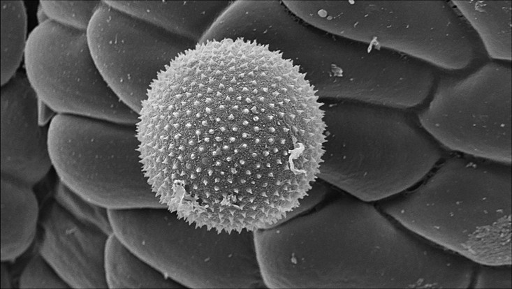 pollen grain of Umbellularia californica scanning electron micrograph of a pollen grain of Umbellularia californica
