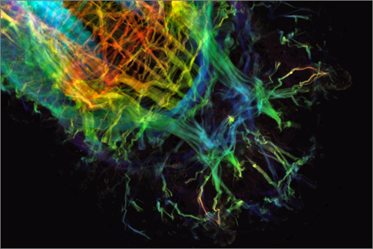CSLM-Aufnahme der Muskulatur eines Plattwurms