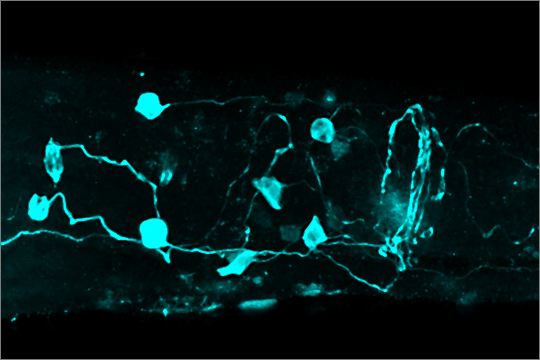 Serotonerge Neuronen im Gehirn eines Nematoden