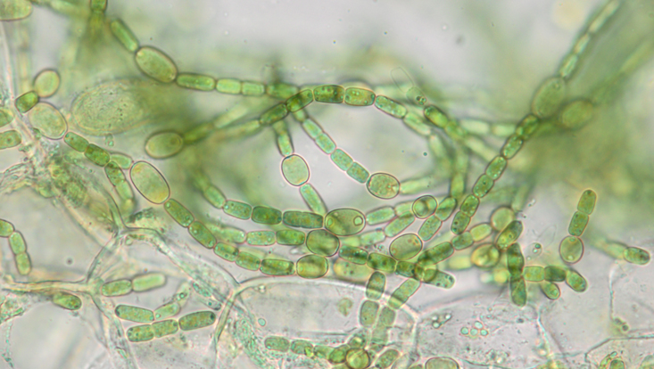 Cyanobakterium Anabaena azollae, mit Heterocyten Lichtmikroskopisches Bild des Cyanobakteriums Anabaena azollae