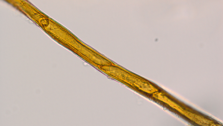 Light microscope photo of a moss rhizoid Light microscope photo of a moss rhizoid