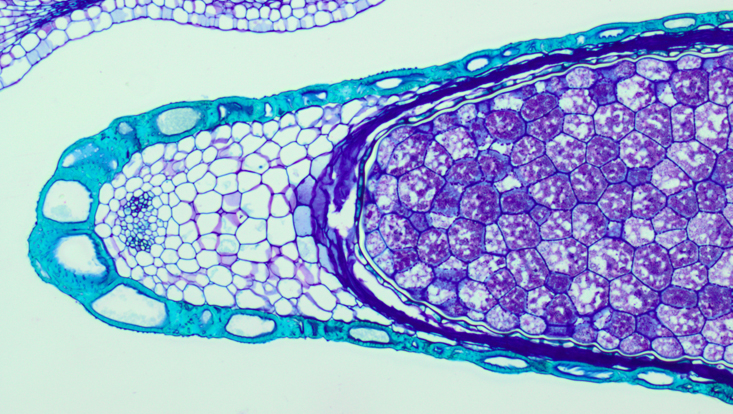 Lichtmikroskopisches Foto eines Querschnitts durch einen Samen von Nymphoides peltata, Außenschichten, Embryo nicht angeschnitten