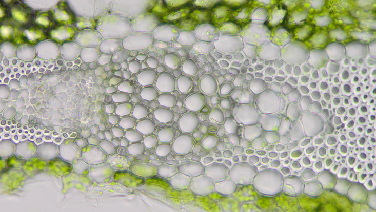Lichtmikroskopisches Foto eines Leitbündels in einem Blattquerschnitt von Phormium tenax, links das Phloem, in der Mitte das Xylem