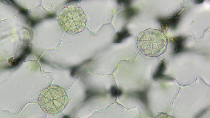 Lichtmikroskopisches Foto der oberen Epidermis eines Fangblatts von Pinguicula, mit mehrzelligen Verdauungsdrüsen