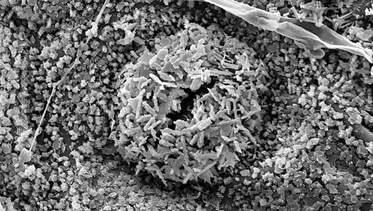Stoma on the lower leaf surface of Cimmamomum camphora in the scanning electron microscope Photo of a stoma on the lower leaf surface of Cimmamomum camphora in the scanning electron microscope