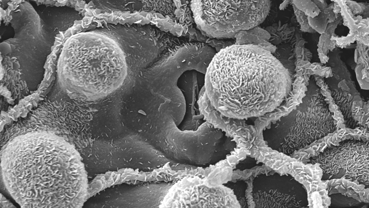 Aniba firmula, lower leaf surface in the scanning electron microscope Photo of the lower leaf surface of Aniba firmula in the scanning electron microscope, with papillae and stoma