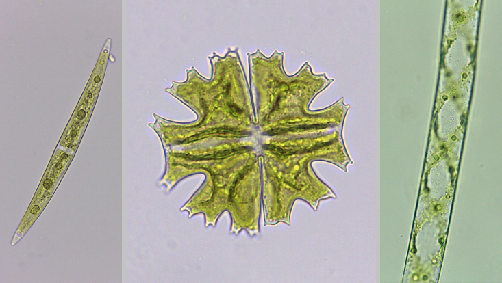 Zygnematophyceae; links: Closterium; Mitte: Micrasterias; rechts: Spirogyra Lichtmikroskopische Fotos von Zygnematophyceae; links: Closterium; Mitte: Micrasterias; rechts: Spirogyra