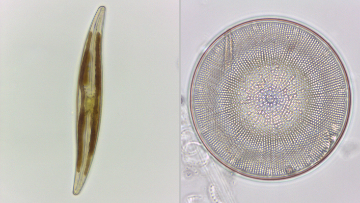 Bacillariophyceae; left: Pleurosigma; right: Arachnoidiscus Light microscope photos of Bacillariophyceae; left: Pleurosigma; right: Arachnoidiscus