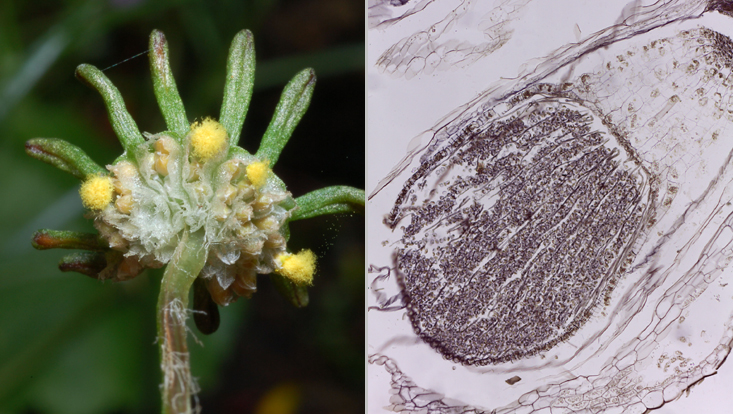 Marchantia polymorpha; left: archegoniophore with sporogones in different stages of development, the outer ones already dehisced; right: light microscope photo of a longitudinal section of an immature sporogone Photos of Marchantia polymorpha; left: archegoniophore with sporogones in different stages of development, the outer ones already dehisced; right: light microscope photo of a longitudinal section of an immature sporogone