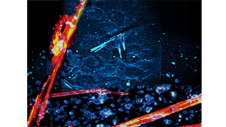 Das multimodale Multiphotonenmikroskop kann unter anderem zuverlässig Salzkristalle (hier rot) von Proteinkristallen (hier blau) unterscheiden.