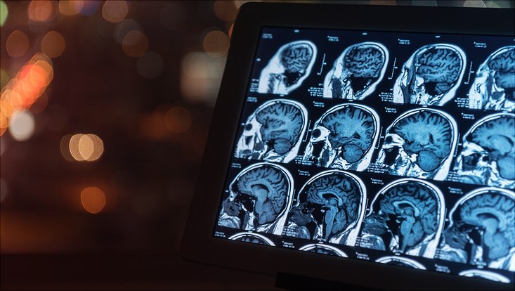 The photo shows a magnetic resonance imaging.