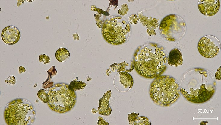 Mikroskopaufnahme von Protoplasten aus Blättern der Ackerschmalwand. Sie ist ein wichtiger Modellorganismus in der Forschung.