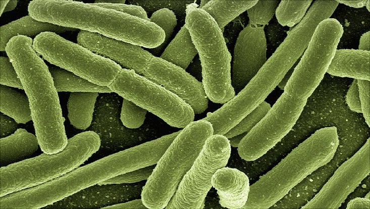 Ein Darmbakterium als Helfer der Forschung Elektronenmikroskopische Aufnahme von Escherichia coli, einem Darmbakterium. Zu sehen sind viele dieser Bakterien.