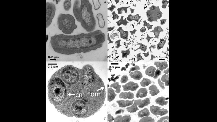 Transmission electron micrographs of Nitrotoga cultures in ultrathin sections