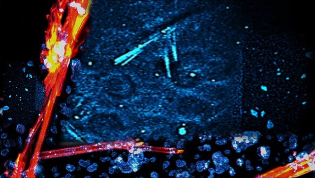 multiphotonenmikroskop-640x361 Links rot-gelber Strich, Mitte blau gesprenkelt, rechts unten rot-gelber Strich