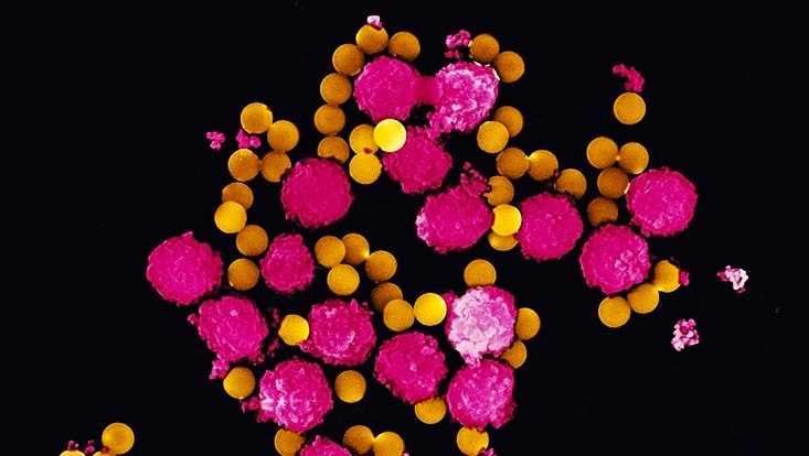 Yellow and pinks balls on a black background