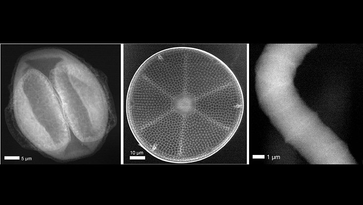 Black and white picture of a cyanobacterium, a diatom, and a pollen grain