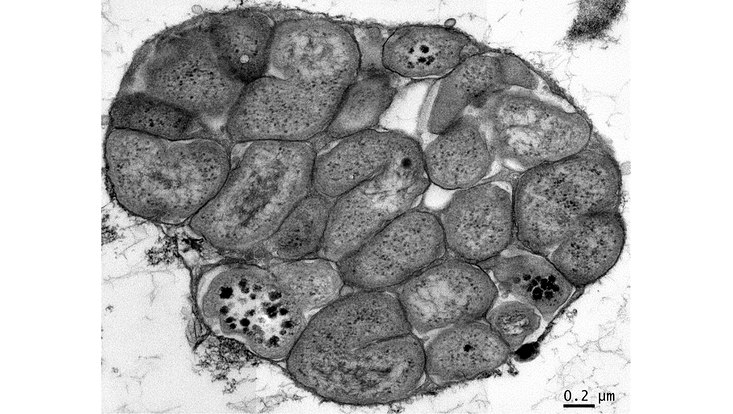 Electron micrographs of N. tepida.