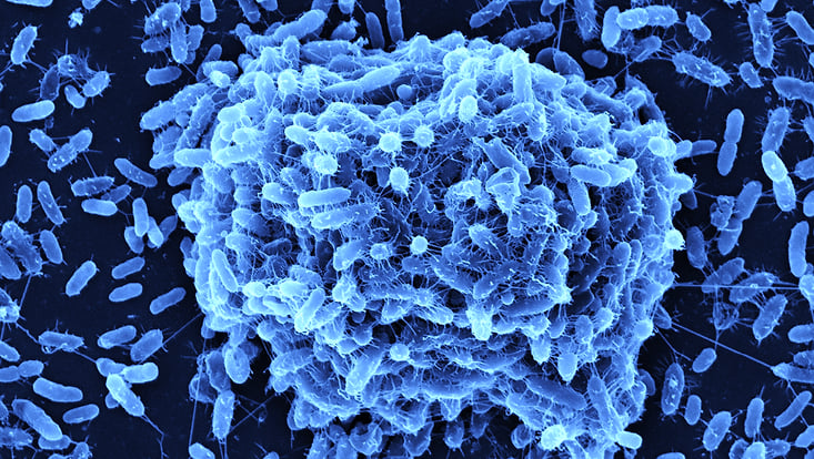 biofilm-formation-733x414 Biofilm formation