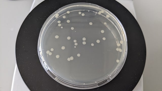 A Petri dish with bacterial colonies on an agar-based growth medium