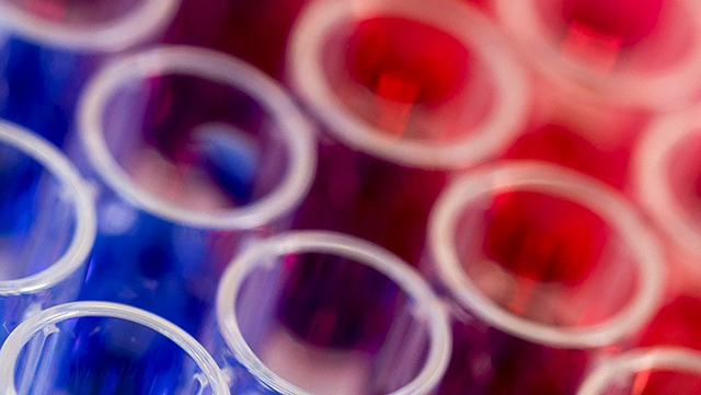 Bunter Reagenzgläser