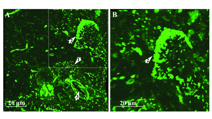 clsm-tim-733x414 Laser scanning microscopy image of L. monocytogenes NCTC 10887
