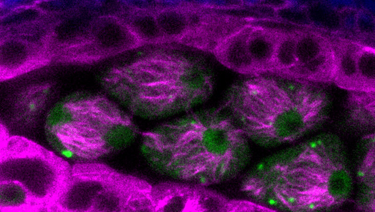 live cell image heat stress in Arabidopsis