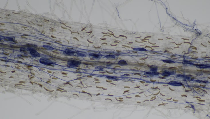 Das Netzwerk des Pilzes Rhizophagus irregularis.