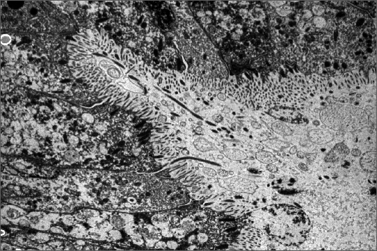 Zähne einer Kaulquappe