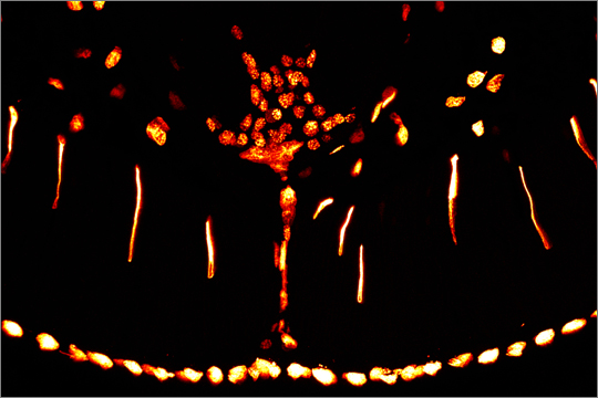 Gordius DAPI Zellkerne in Gordius aquaticus