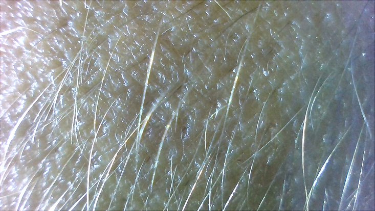 goosecam-arm-733x414 Aufnahme der Gänsehautkamera