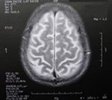 Die MRT-Aufnahme eines Gehirns